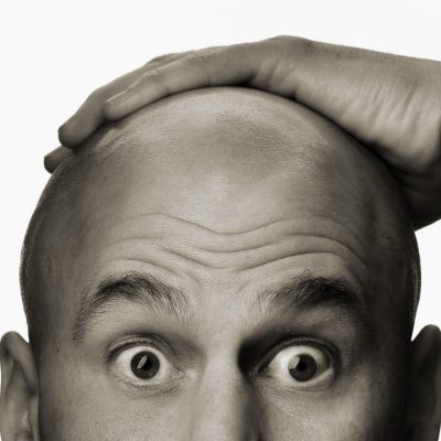 Hair Loss Treatment Options For Men